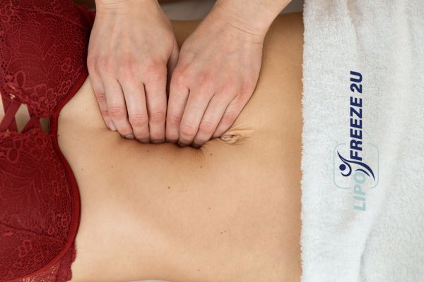 diastasis recti treatment Rainham