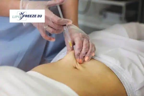How Does Aqualyx Fat Dissolving Injection Work to Break Down Fat Rainham?