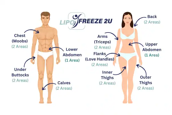 Areas you can have fat freezing treatment Rainham