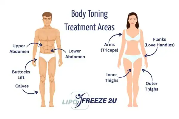 Graphic showing where you can have Body toning Treatment Rainham on your body