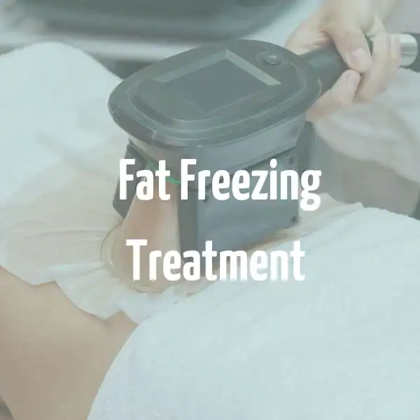 fat freezing treatment Rainham