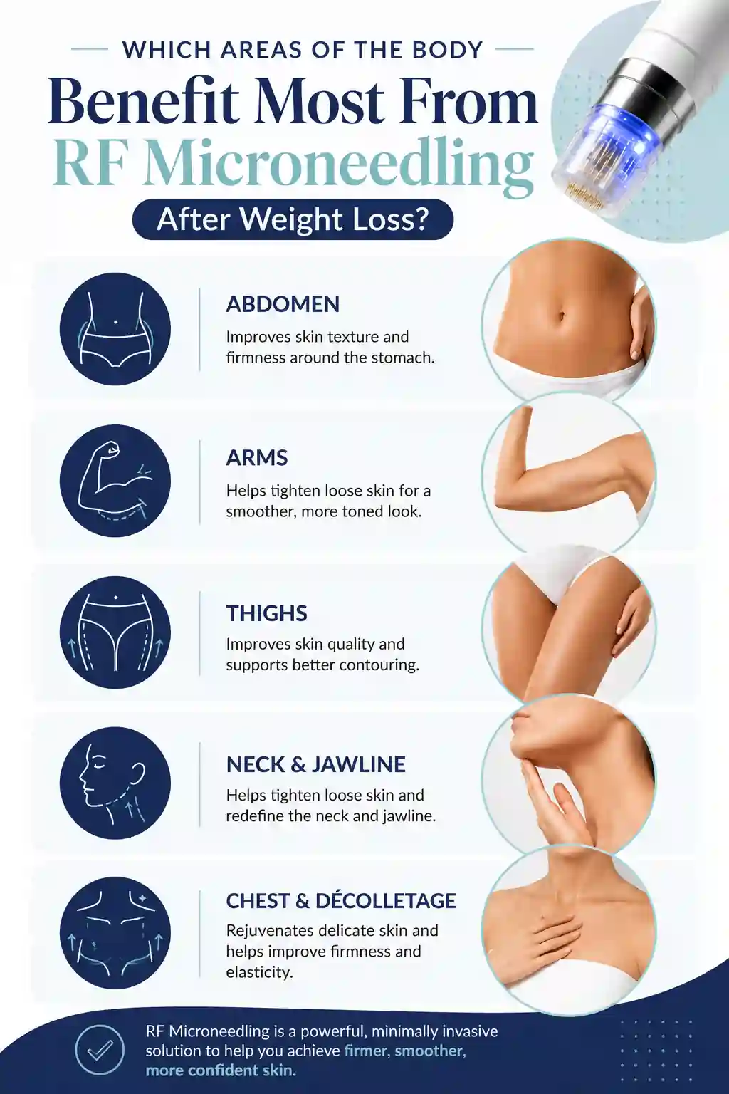 Which Areas of the Body Benefit Most From RF Microneedling After Weight Loss Rainham